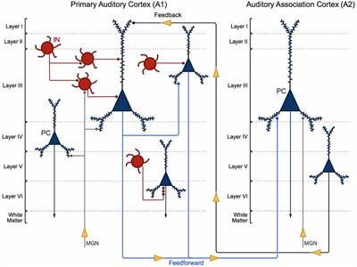 Stereological Assessments of Neuronal Pathology in Auditory Cortex in Schizophrenia